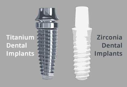 Types of Dental implant